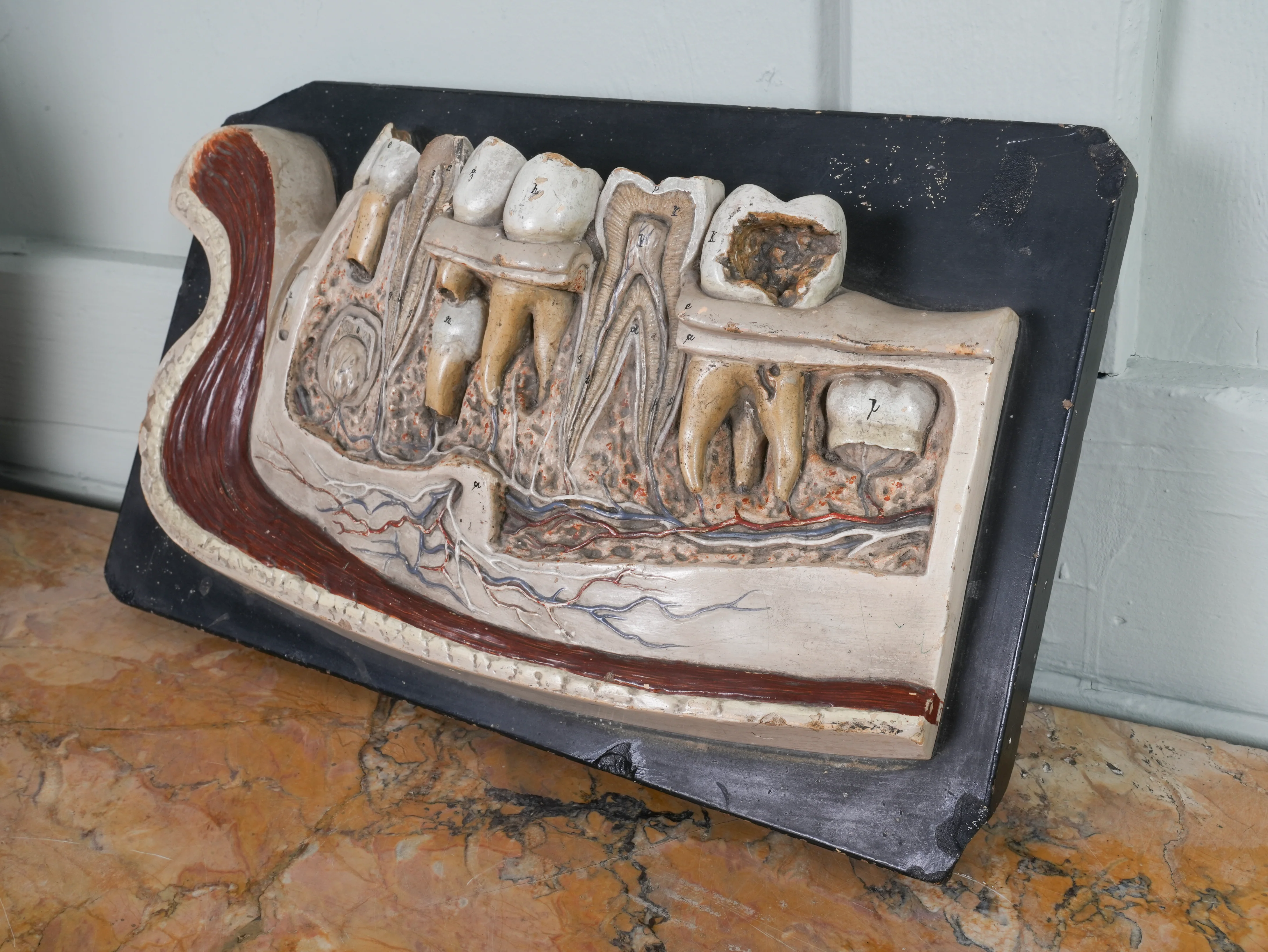 A 19th Century Plaster Didactic Model of Malformed Teeth - Image 6