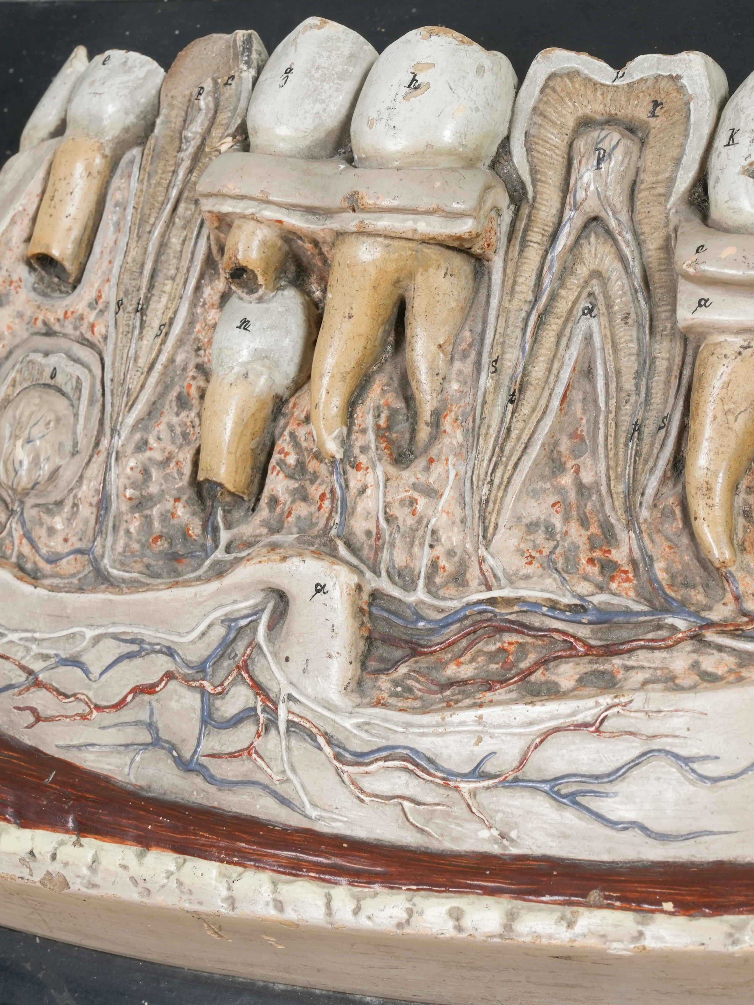 A 19th Century Plaster Didactic Model of Malformed Teeth - Image 7